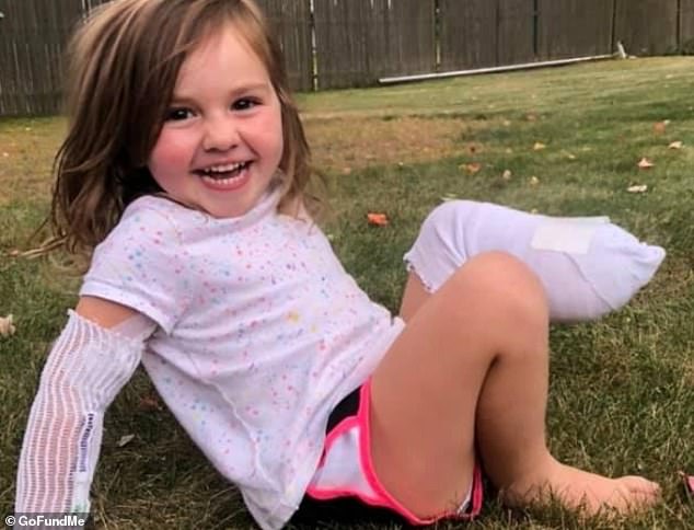 A mother has shared her distress after her three-year-old daughter (pictured) lost her leg when running behind a reversing ride-on lawnmower in front of her six-year-old sister