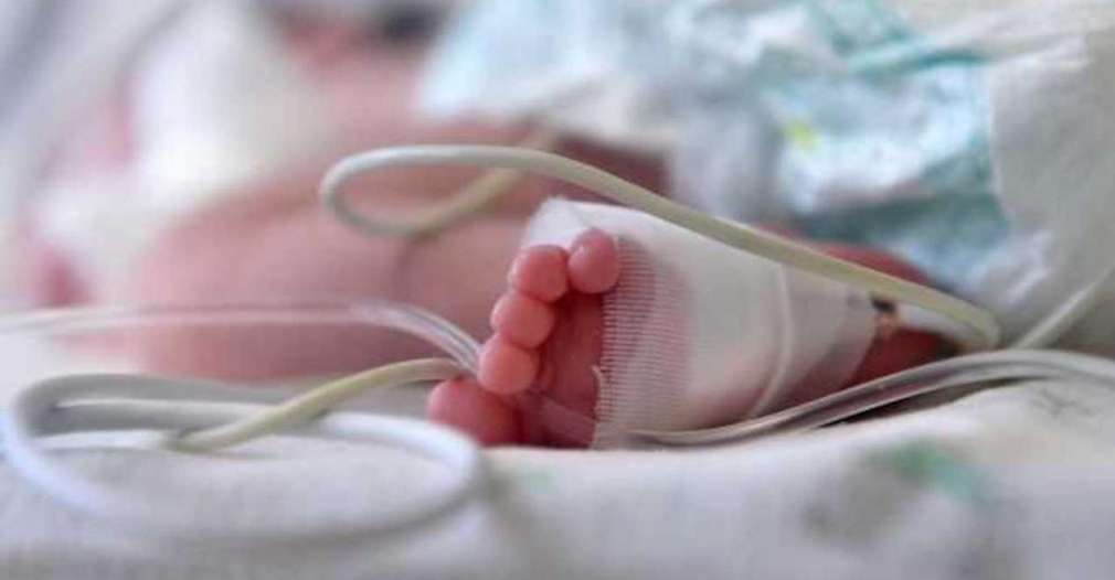 Bebé de 2 meses es atendida luego de resultar quemada en su cara con pólvora en Barranquilla