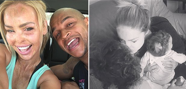 Who is Katie Piper? Husband, children and life before acid attack revealed