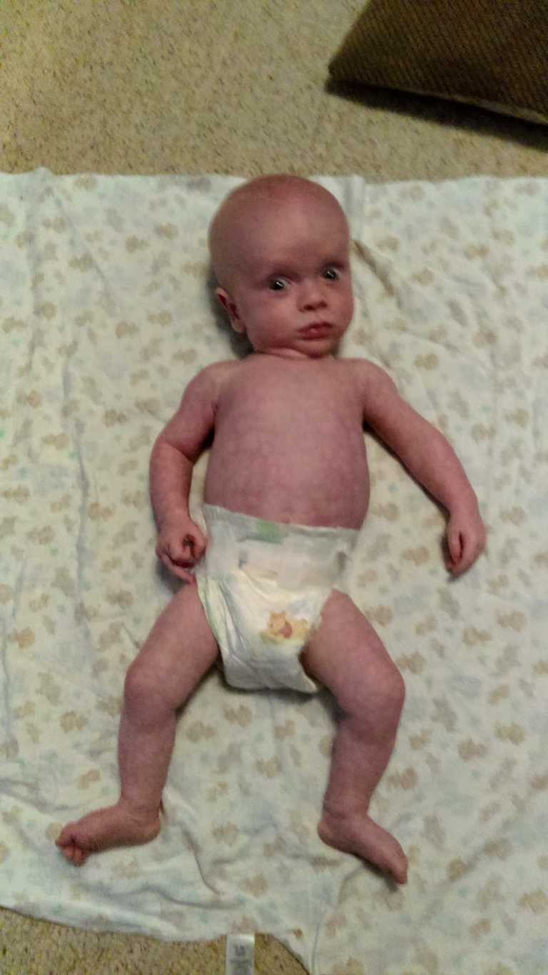 Foster parents adopt shaken baby survivor : ”They had better things to do than feed him”