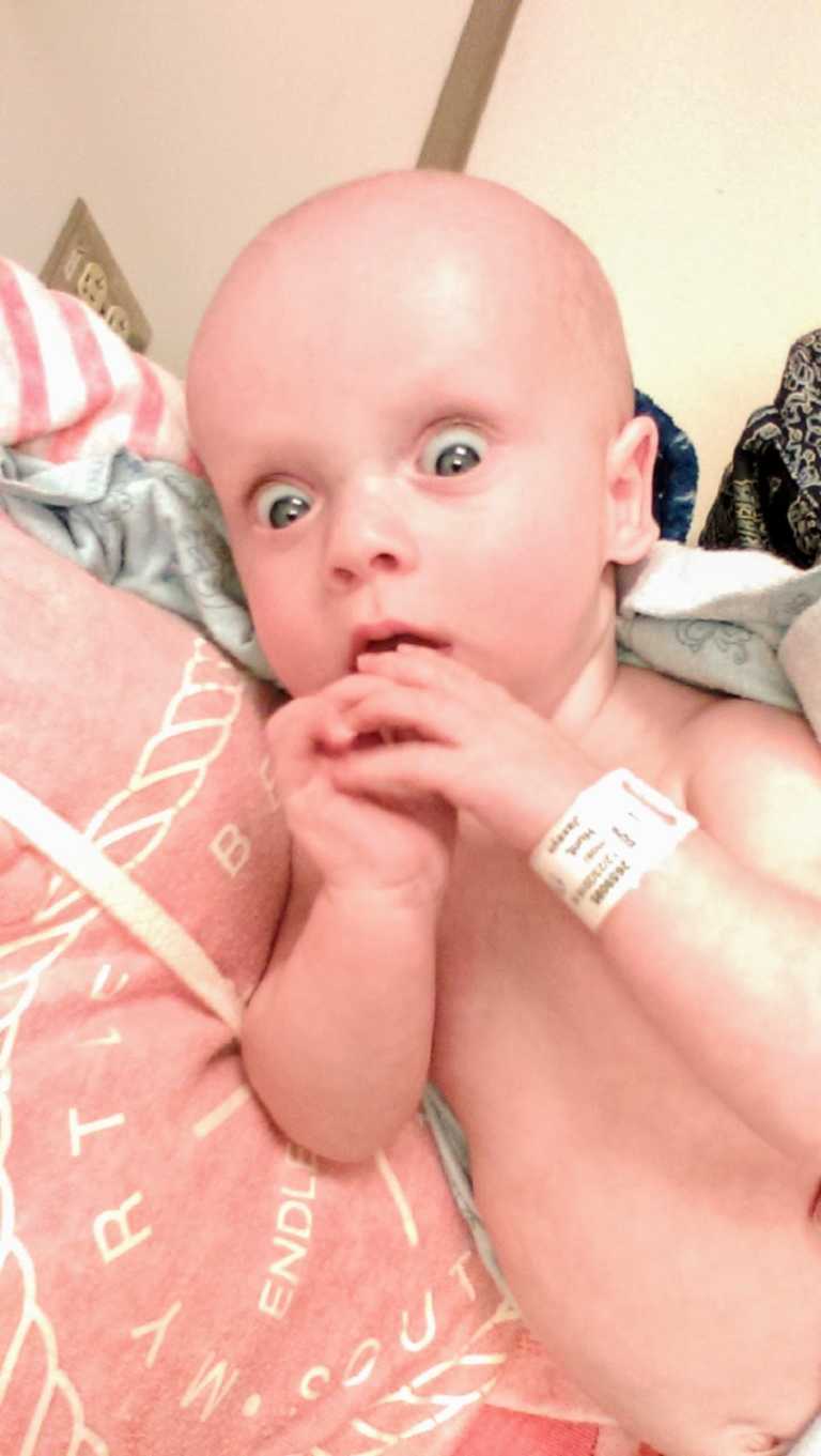 Foster parents adopt shaken baby survivor : ”They had better things to do than feed him”