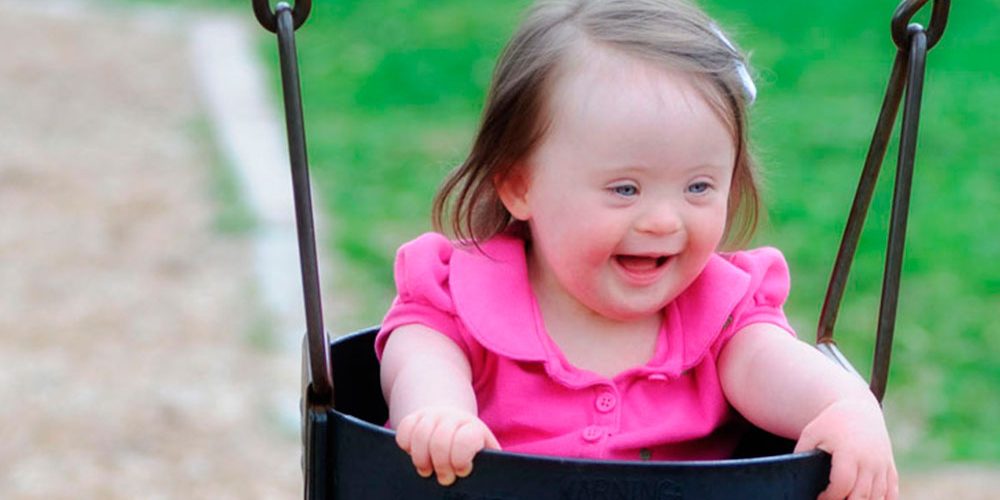 Existen grados en el síndrome de Down? – El Cisne