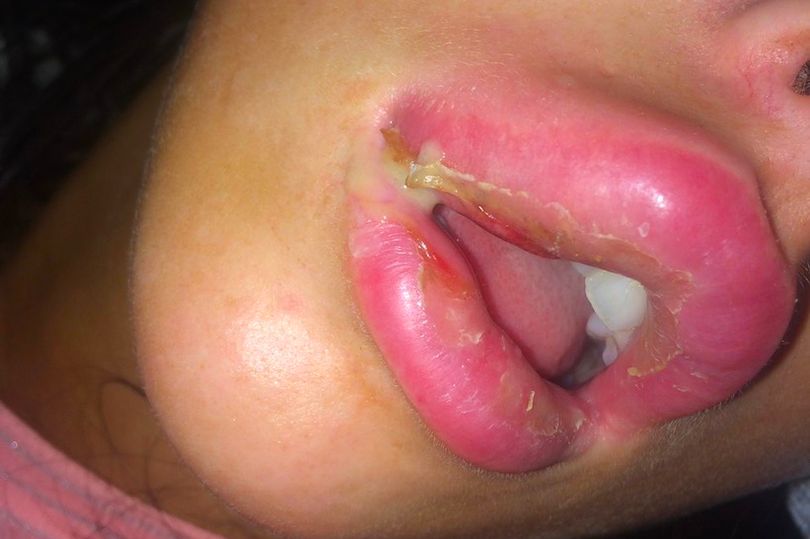 inkl - Woman feared she