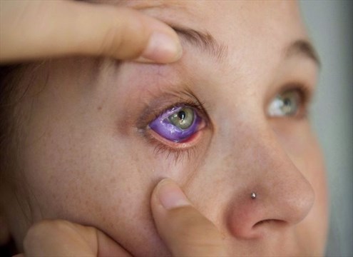 eyeball tattoos