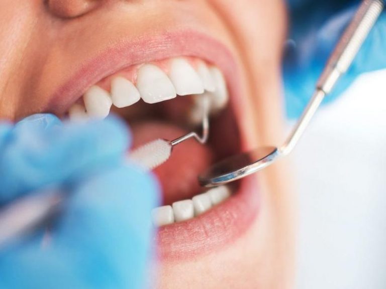 Cracked teeth, gross gums: Dentists see surge of problems, and the pandemic is likely to blame | News Break