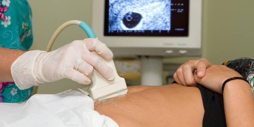 Aborto: ¿qué es y por qué ocurre? | CuidatePlus