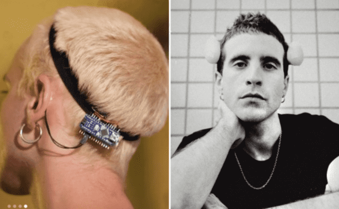 Se implanta aletas de pez en el cráneo; se define como transespecie