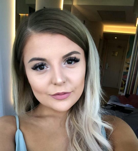 Microwave နဲ့ကြက်ဥပြုတ်ရာမှ မျက်လုံးတစ်ဖက်ကန်းမလို ဖြစ်ခဲ့ရတဲ့မိန်းကလေး | SHWEMOM