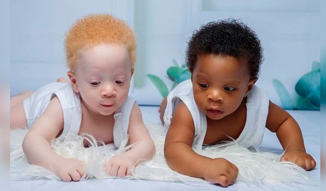 Hermanos mellizos "casi" idénticos.
Fotos: @stacyomo