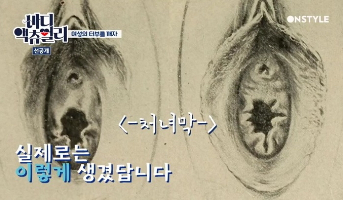 산부인과 의사가 말하는 