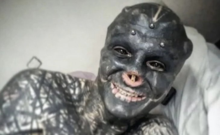 Un hombre se extirpó la nariz, el labio y las orejas para parecerse a un alienígena