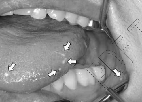 오징어 정포 이미지 검색결과