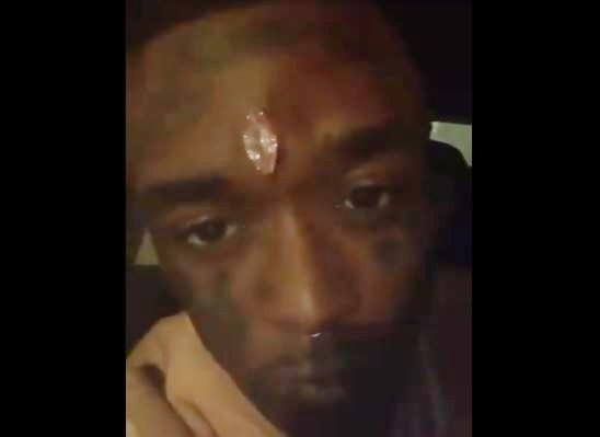 "아름다움은 고통" 이마에 270억원 보석 박은 미국 가수