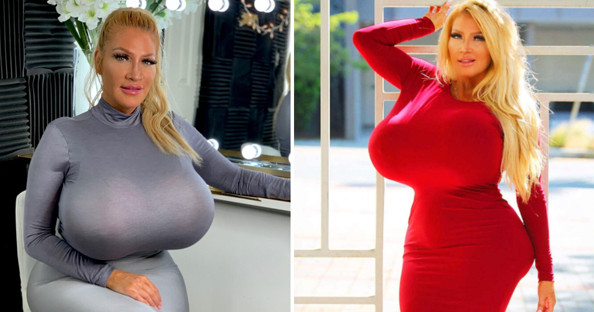 eerrrrwww.jpg - Mom Goes From 'Drab To Fab' With Gigantic 4,600 CC Implants