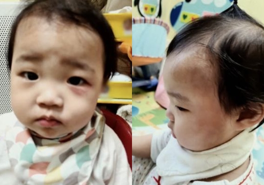 정인이 멍 외면한 홀트·아동기관…양모 위로한 경찰”-국민일보