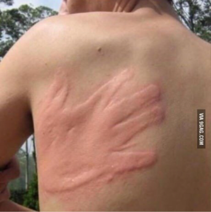 What does "맞아본 적도 없는 등짝 스매싱" mean? - Question about Korean | HiNative