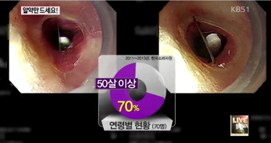 이 이미지는 대체 속성이 비어있습니다. 그 파일 이름은 20210316183634.png입니다
