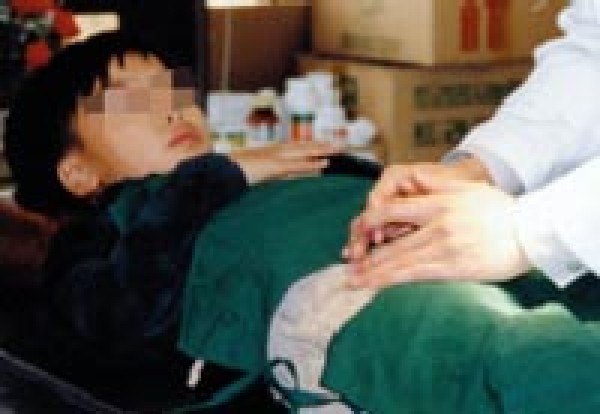 포경수술 시기 초등4~중학3