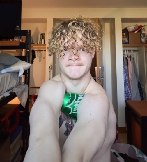 Man Born With No Collarbones Says His Condition Is ‘Awesome’ Because It