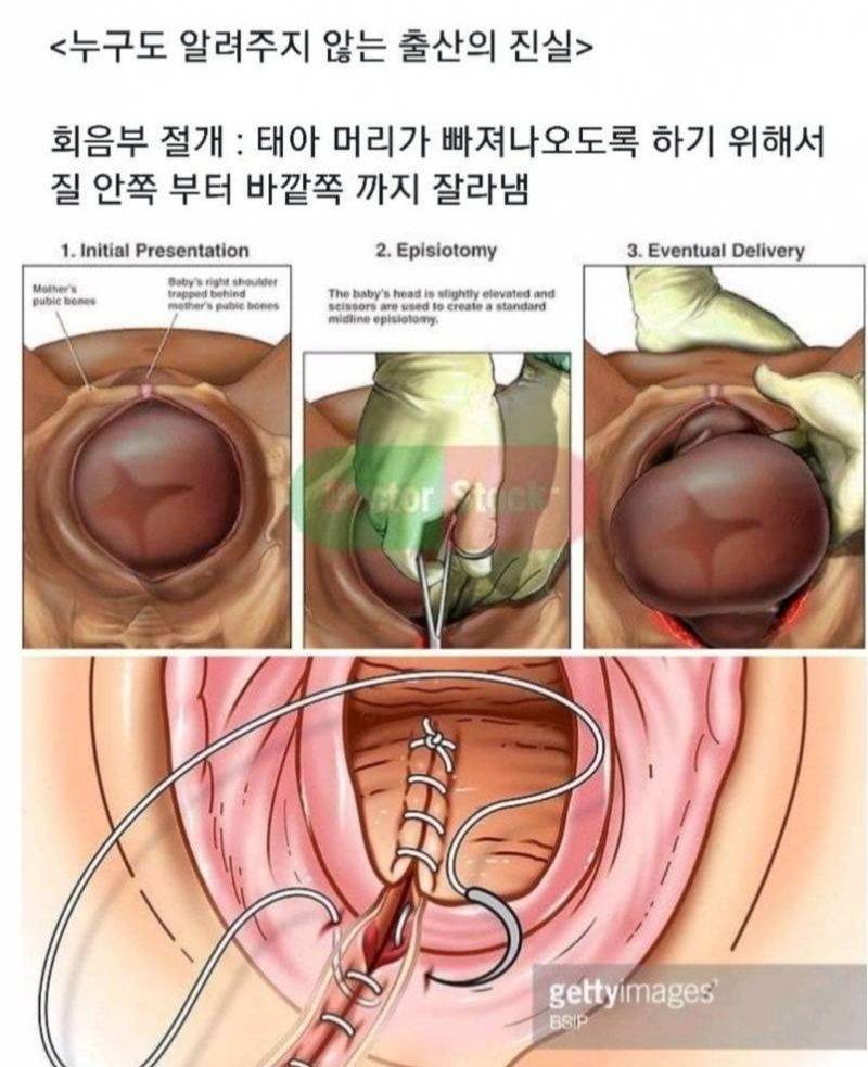 카디비도 몰랐던 여자가 출산할때 겪는일.jpg | 인스티즈