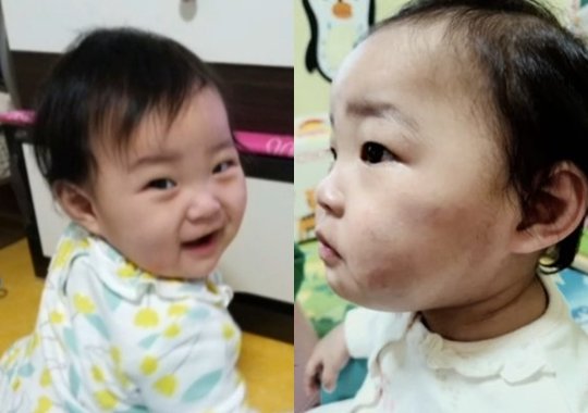 정인이 사건, 살인죄” 소아청소년과 의사단체, 의견서 제출 : 뉴스 : 동아닷컴