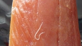 毎週 サーモンの刺身 を食べた女性のお腹の中から7m寄生虫が出てきた Hachibachi