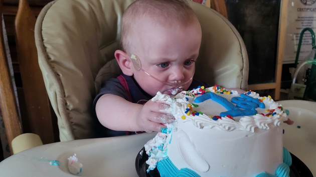 The World's Most Premature Baby Celebrates First Birthday After ZERO ...