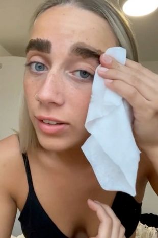 The dye stained her skin around the eyebrows