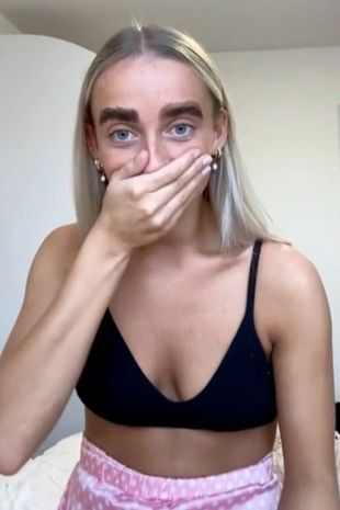 Libby was left with huge splodges of dye around her eyebrows