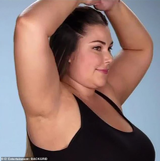 woman-reveals-she-grew-two-new-br-asts-in-her-armpits-during