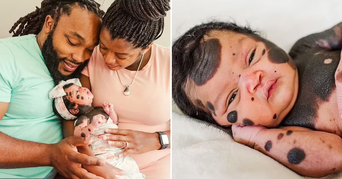 baby6.jpg - Baby Girl Born With Dark Spots All Over Her Body Inspires Others To Embrace Their Unique Looks After Becoming An Internet Sensation