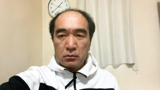 療養中の江頭2:50、病名非公表の理由語る「それ言うとお前ら…」 |