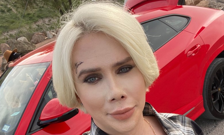 트랜스인종 인플루언서 Oli London, 음경 축소 수술 계획 공개