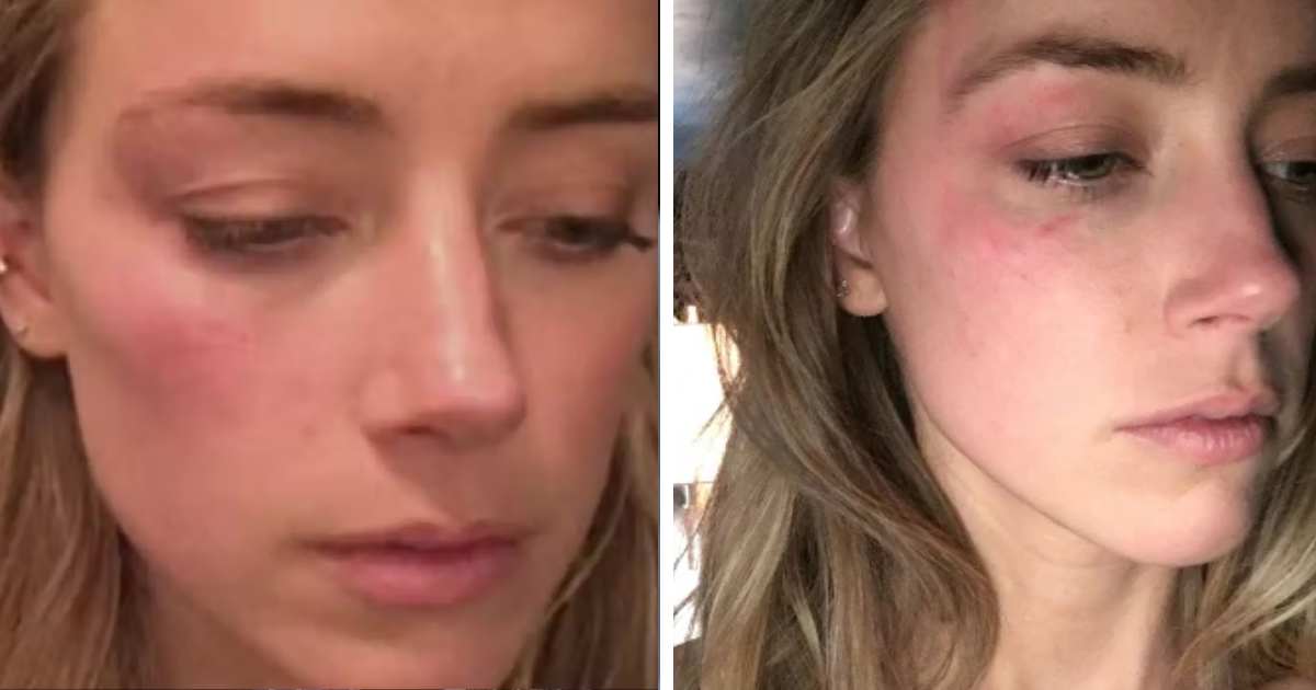 d2.png - BREAKING: Amber Heard Says Image Of Johnny Depp With TWO BLACK EYES Was 'Photoshopped'