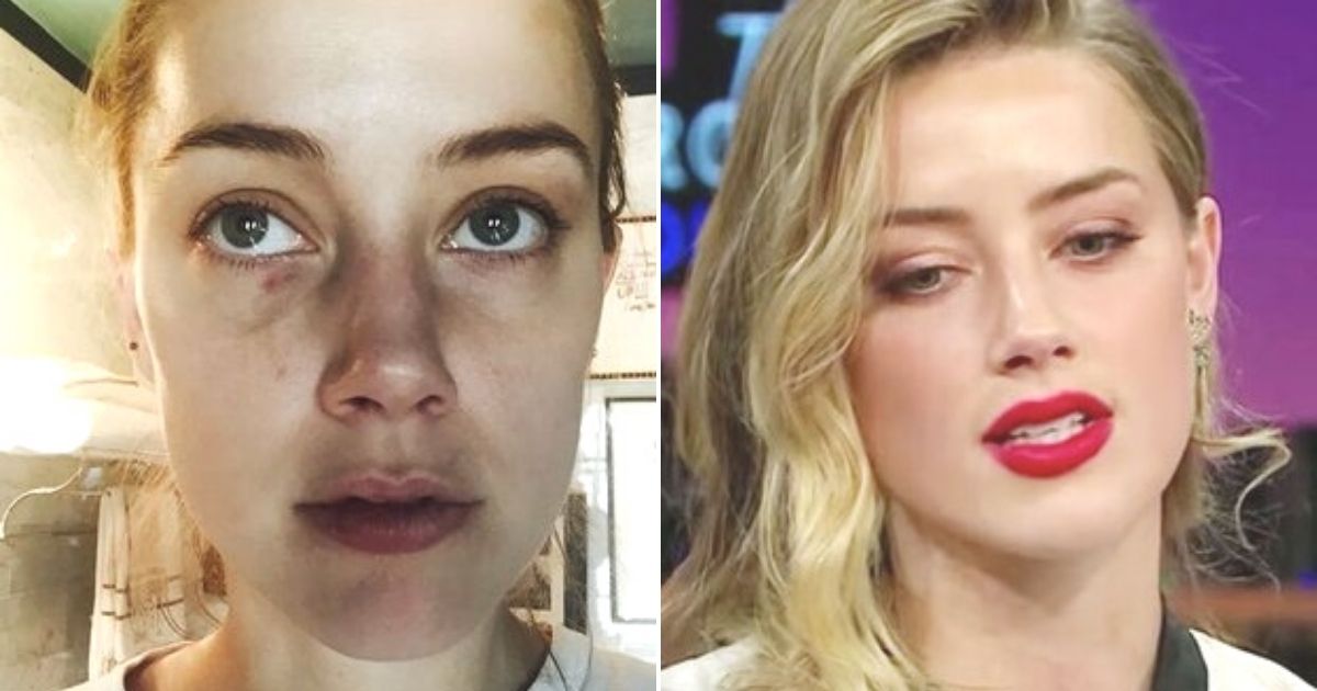 untitled design 52.jpg - JUST IN: Amber Heard's Makeup Artist Recalls Covering The Actress’s Bruises With Makeup After The Couple’s Alleged Fight