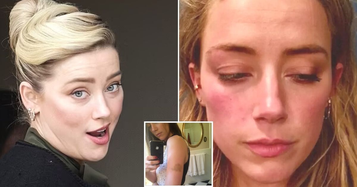 untitled design 87 1.jpg - JUST IN: Photos Showing Amber Heard's Bruises Were EDITED, Digital Forensic Expert Testifies