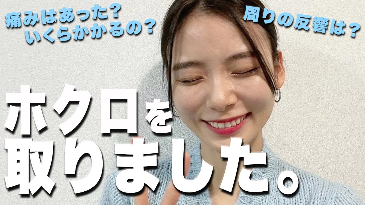 実体験】顔のホクロを取りました!費用など全てをお話しします【朝日奈央】 - YouTube