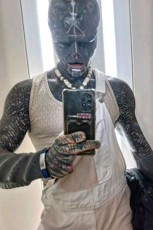 Man Who Transformed Into A 'Black Alien' Now Wants To Cut Off His LEG ...