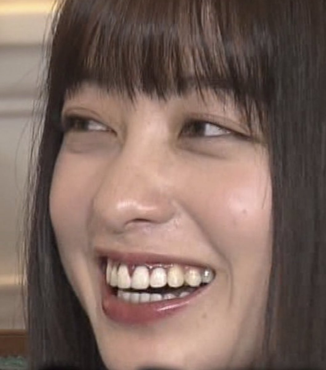 歯歯歯歯 on Twitter: "キツい これ相当キツい 美少女の歯茎がヘタクソ差し歯のせいでこんなに真っ黒なんてコレやった歯科医は廃業した方がいい #橋本環奈 https://t.co/ngs7tDxHA9" / Twitter