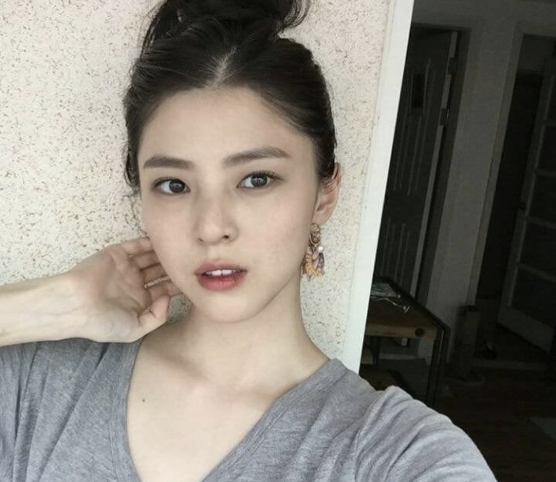 헐 한소희도 모발이식 했던거네 : 네이트판