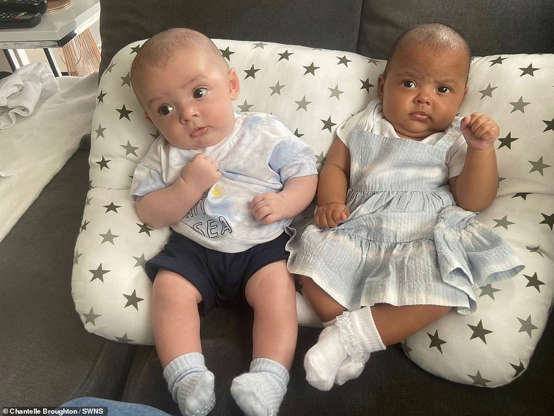 Exclusive One In A Million Twins Born With Different Skin Colors Pictured For The First Time