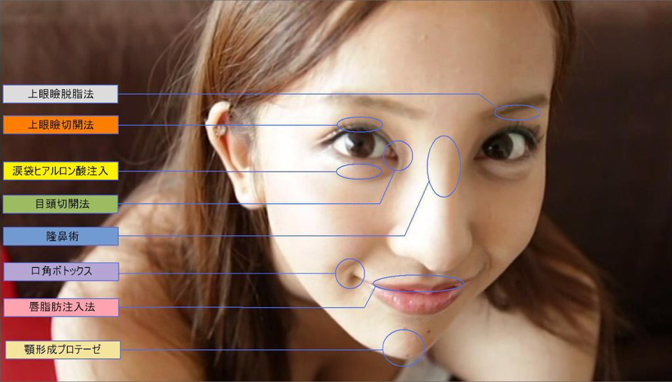 🥫🍆Kannasty📕🧸 on Twitter: "整形モンスター板野友美 https://t.co/WEH0sjMdSa" / Twitter