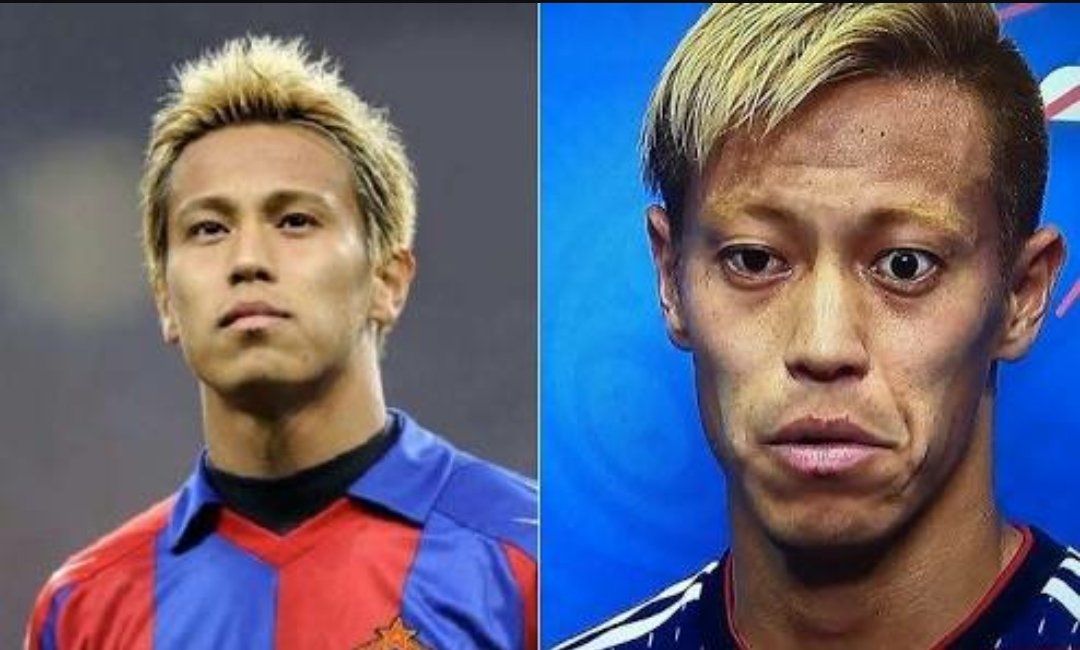 Twitter 上的 ❤🔃有難う🐶by.misao:"【本田圭佑】 人間の顔って、こんなに変わるものなんだね。 まるで別人ですが、同一人物です。 バセドウ病との噂もありますが、病気って怖い😨 (左写真) 若かりし『本田圭佑』 (右写真) 現在の『本田圭佑』 人の顔の事、アレコレ言う ...