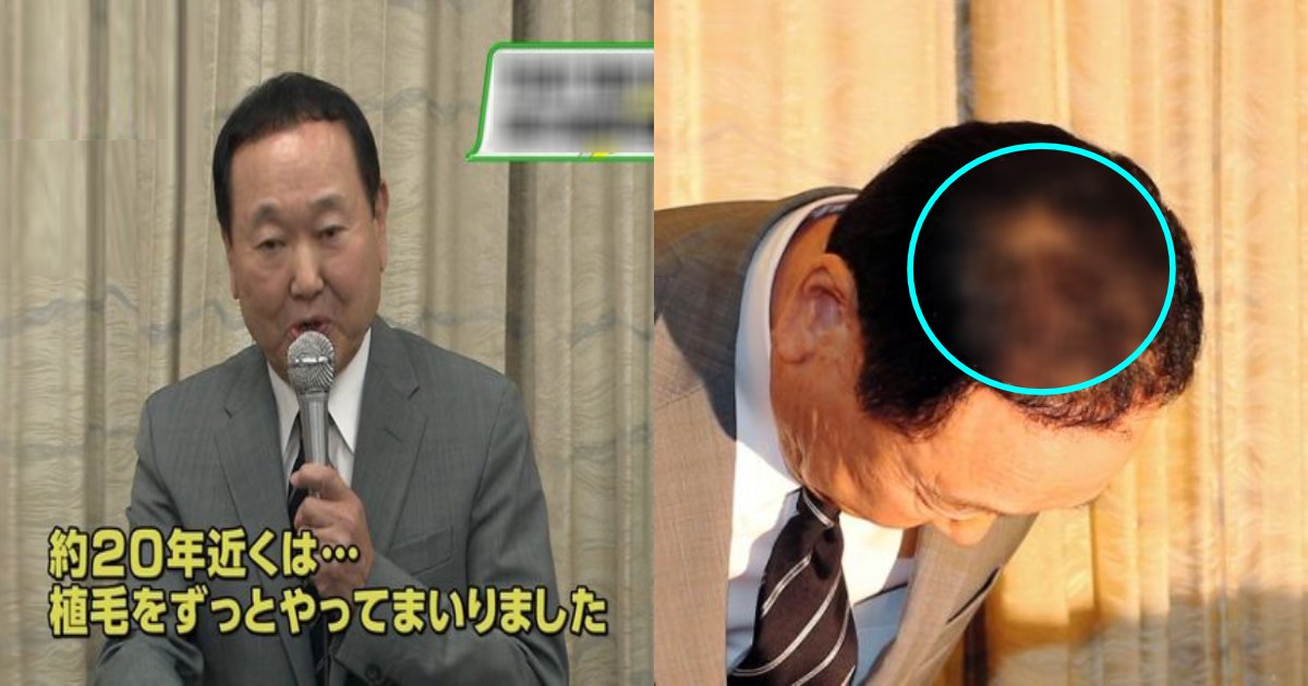 e696b0e8a68fe38397e383ade382b8e382a7e382afe3838895.png?resize=1200,630 - 板東英二、申告漏れ7500万円！「植毛は経費だと思った」聞き苦しい言い訳…「同情を誘う気か」「ハゲを利用するな」