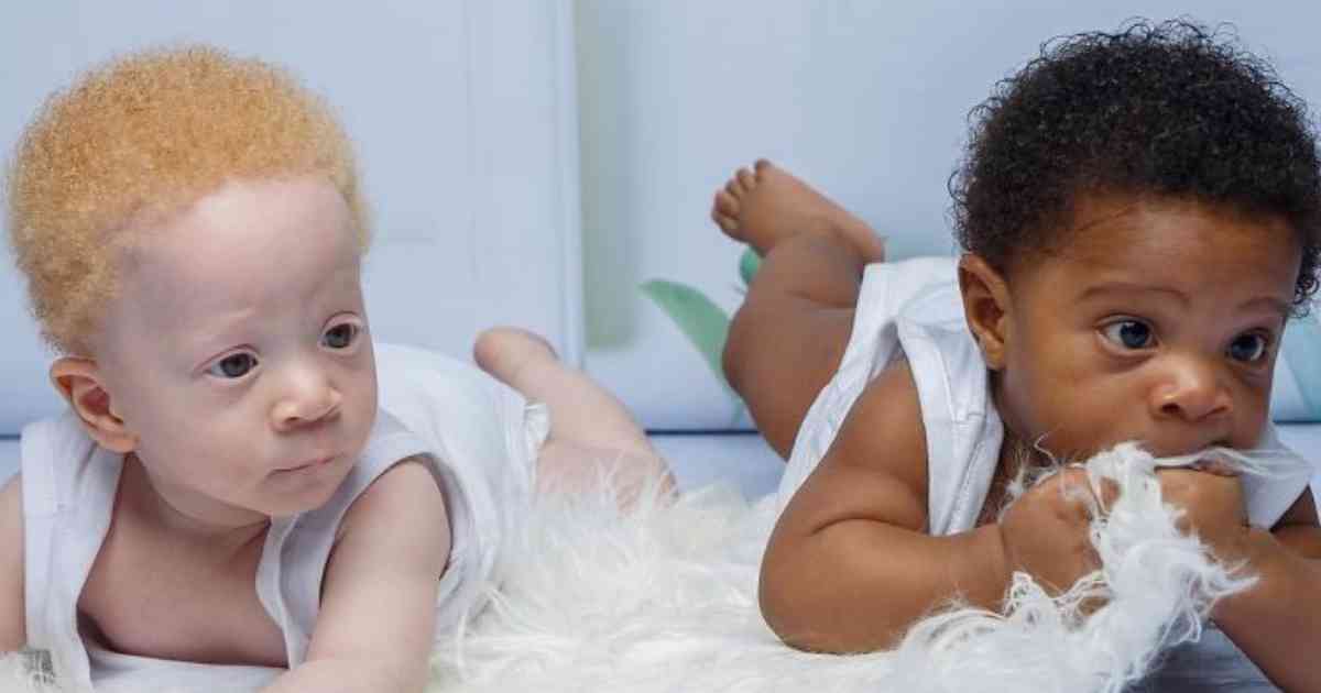 bb.jpg - Une Mère Remet les Pendules à L'Heure à Propos de ses Jumeaux Identiques Biologiquement " Noirs et Blancs "
