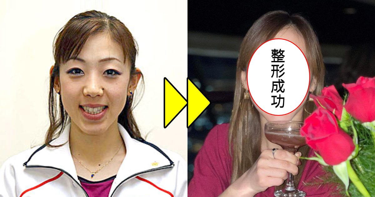 元フィギュア・村主章枝、ホクロ除去と鼻をイジった?垢抜けした近影に「顔面が変わりましたね」「まるで別人のよう」