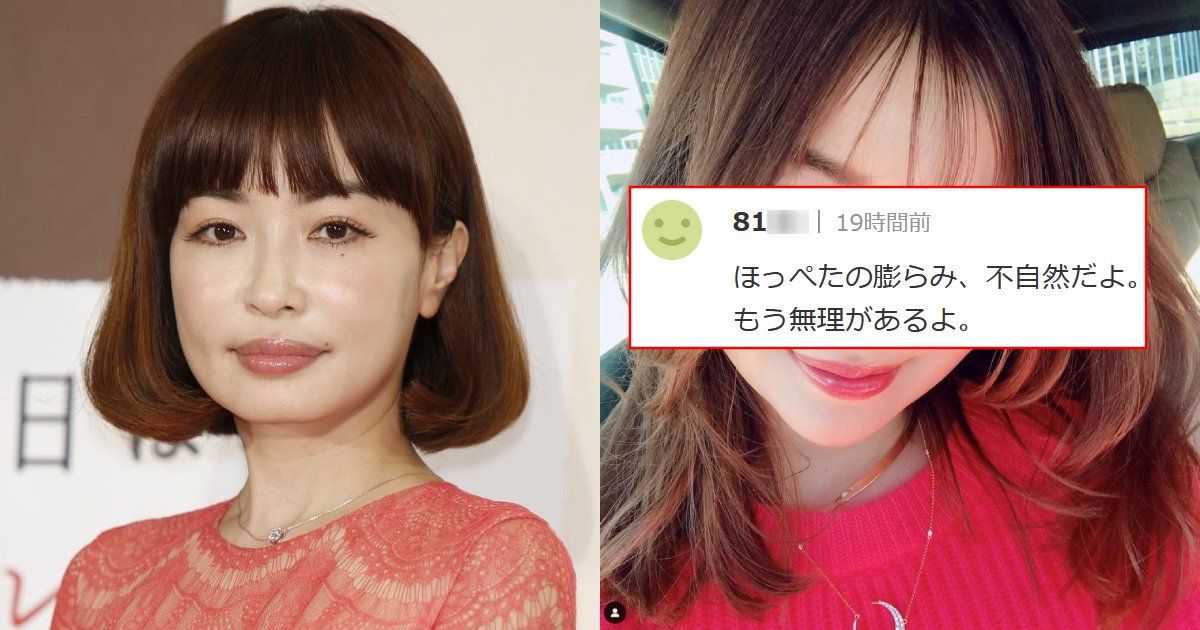 平子理沙、52歳の現在の姿。今にも弾けそうな『パンパン顔』に厳しい声「人工的な違和感」「頬にコブがありますよ」