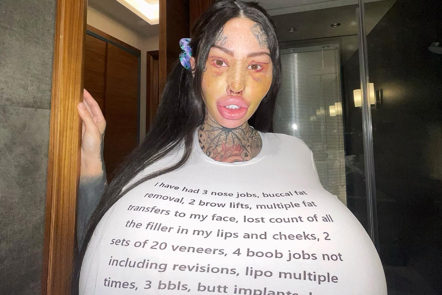 Surgery addict TikToker shares unrecognisable pic before ops worth £70k |  The US Sun