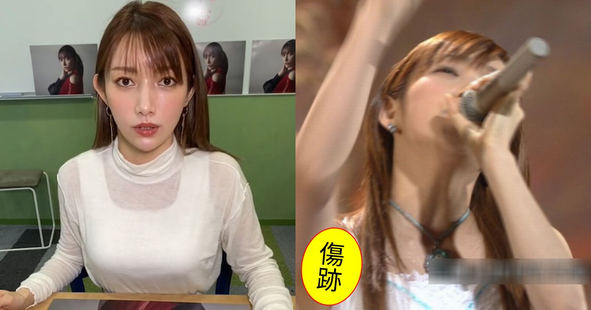 後藤真希、バ〇トは作りモノだった?痛々しい『ワキの傷』が証拠か…「確実にデカくなった」「そこまでしなくても…」