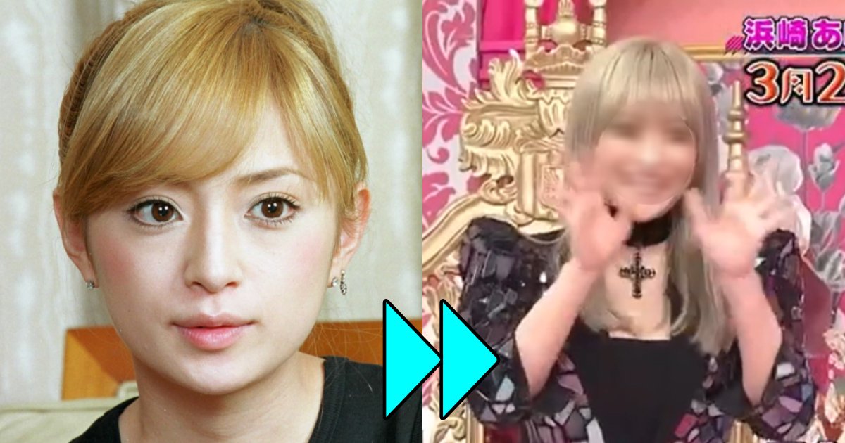 【悲報】浜崎あゆみ、顔面崩壊か。パンパンに膨れ上がり面影あらず…「昔は可愛かったのに」「そろそろ引退したほうが…」